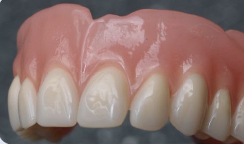 7-daagse prothetiekcursus