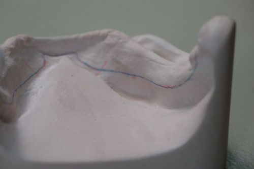 7-daagse prothetiekcursus