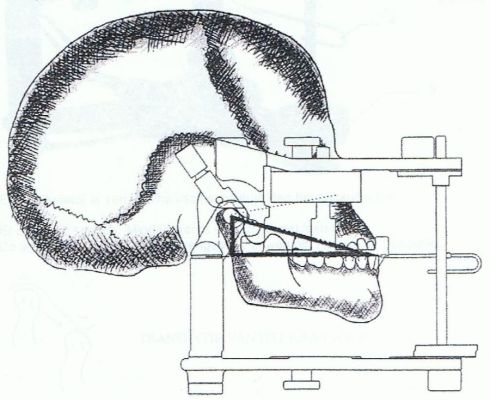 Beetplaten & gipstechniek 2