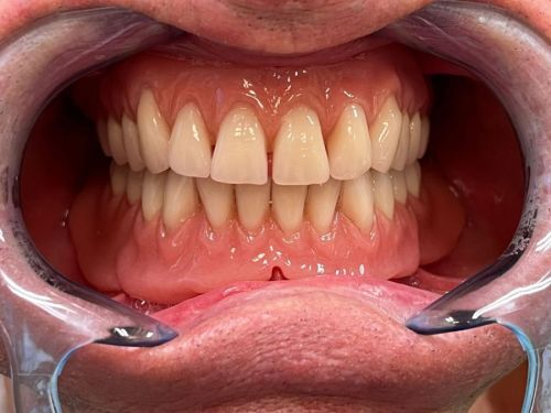 D-DEC Musical Denture Event 