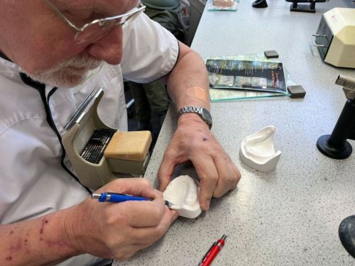 Individuele lepels & gipstechniek 1