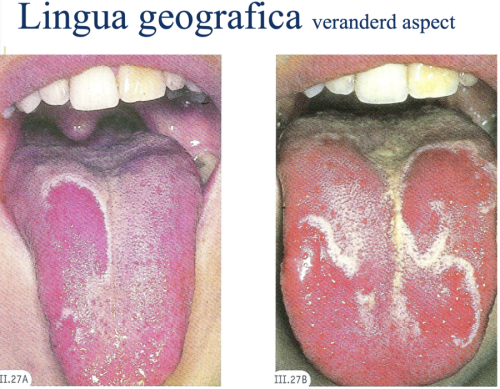Introduction to Special Pathology
