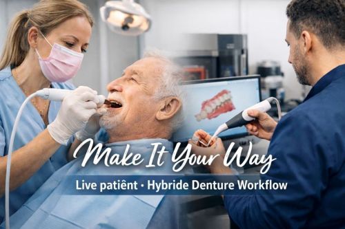 NEW Make It Your Way - Hybride Denture Workflow met live patiënt