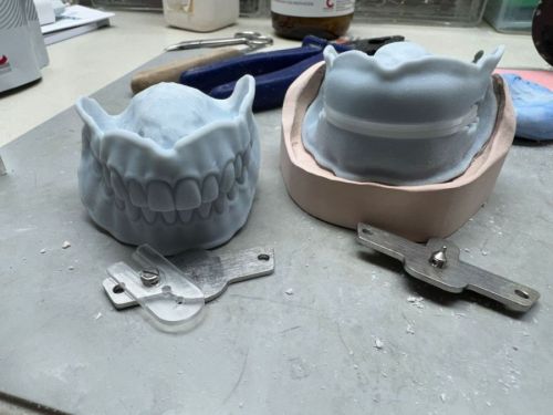 NEW Make It Your Way - Hybride Denture Workflow met live patiënt