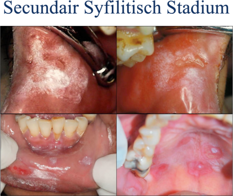 Opfriscursus Speciële Pathologie I & II