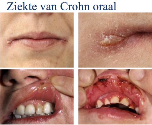 Opfriscursus Speciële Pathologie I & II