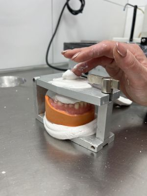 Relining op implantaten